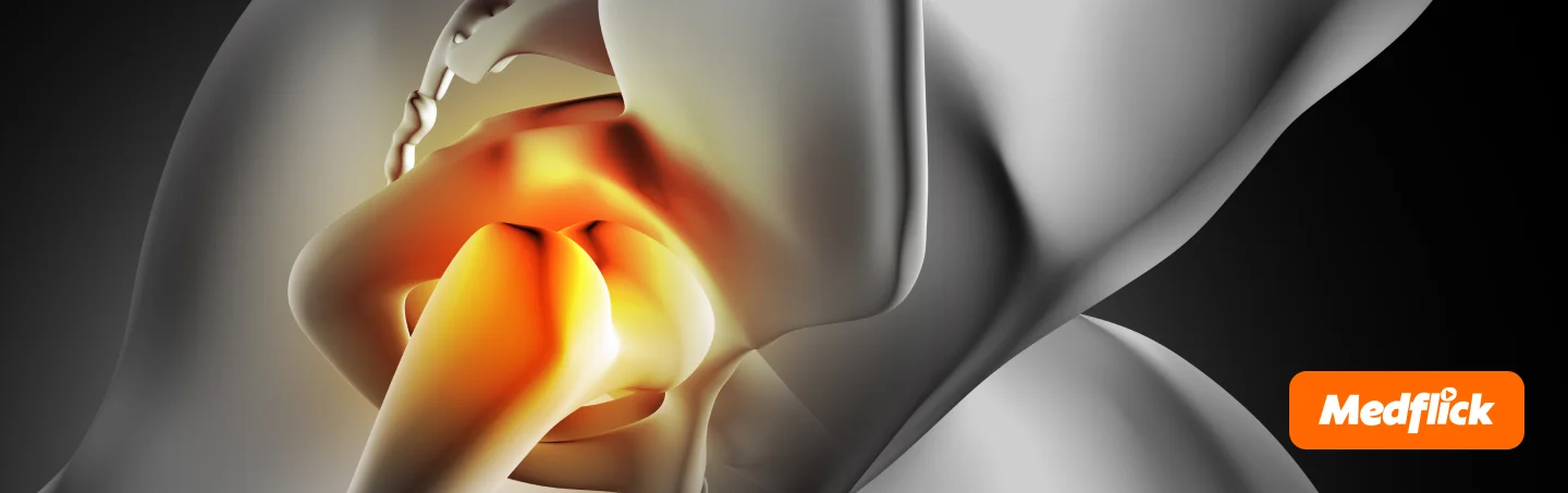 Know Common Hip Problems Appropriately